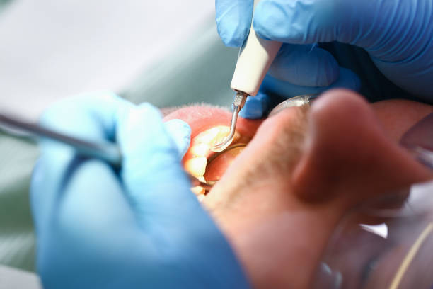 Best Pediatric Emergency Dentist in Brentwood, MD